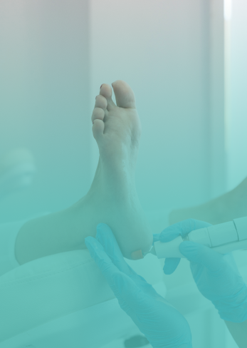 Manutenção de Micose